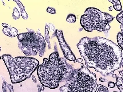 Índia confirma casos de vírus Nipah e coloca mais de 100 pessoas em quarentena
