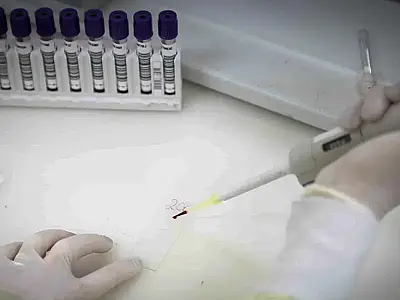 Paciente com suspeita de Ebola testa positivo para meningite em SP