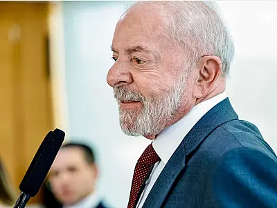 Lula recebe alta após cirurgia de catarata no olho esquerdo