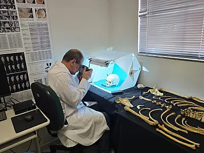 Estudo de perito da Polícia Científica de MS é publicado pela UFMS e amplia recursos da medicina leg