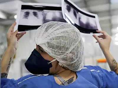 Câncer de pulmão: 15% dos casos acontecem em não fumantes
