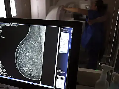 Você sabia? Trabalhador pode tirar três folgas por ano para exames preventivos