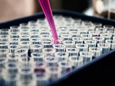 Estudo mostra que inflamação no cérebro pode ser chave do Alzheimer