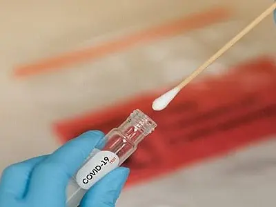 Mudança de Protocolo do Ministério da Saúde deixa Campo Grande sem testes de Covid-19