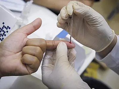 Aumento de casos de hepatite A em Campo Grande alerta autoridades de saúde