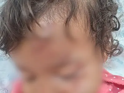 Bebê morre após atropelamento, alta médica e suspeitas de negligência em Campo Grande