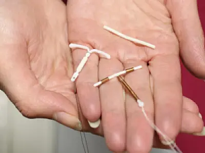 Mato Grosso do Sul amplia acesso a métodos contraceptivos de longa duração