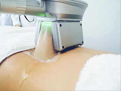 Mulher sofre queimaduras após criolipólise em clínica de Campo Grande e fica internada por 5 dias