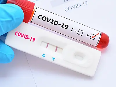Procura por testes de covid-19 sobe em farmácias de Campo Grande, mas escassez preocupa população