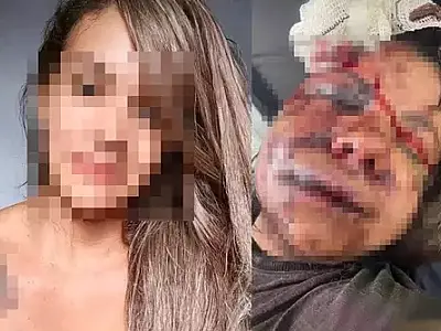 Após sofrer mais de 60 socos do companheiro, vítima desabafa: "Preciso focar na minha recuperação"