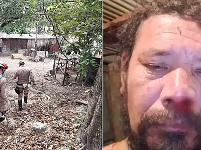 Sobrevivente de ataque de onça em Corumbá relata momentos de terror: "Achei que fosse morrer"