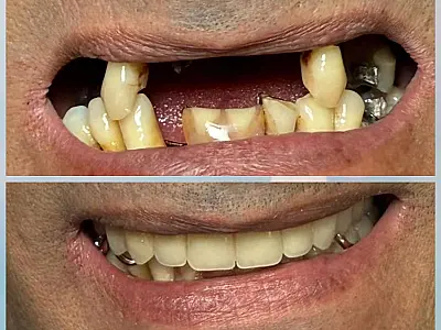 Projeto social "Um Sorriso Muda o Mundo" transforma vidas de colaboradores em Campo Grande
