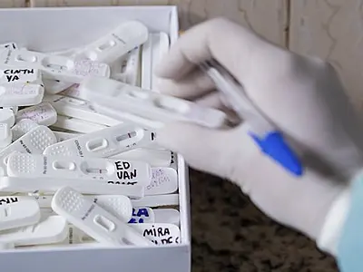 Mato Grosso do Sul recebe 16,6 mil testes rápidos de antígeno para Covid-19