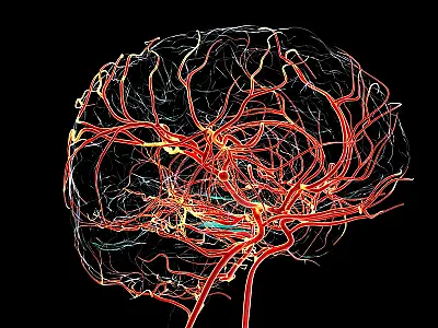 Queda no fluxo sanguíneo cerebral pode estar ligada ao início do Alzheimer, aponta pesquisa