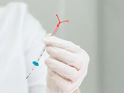 Campo Grande amplia acesso a métodos contraceptivos, incluindo o DIU