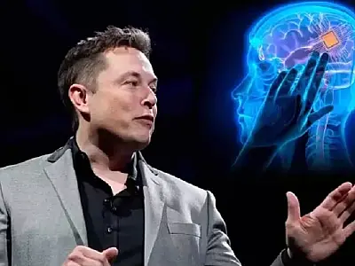Elon Musk anuncia primeiro implante bem-sucedido de chip cerebral em humano