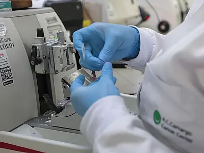 Pacientes com leucemia mieloide terão acesso a nova terapia pelo SUS