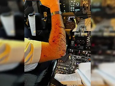 Objeto desconhecido atinge avião nos EUA e fere piloto, forçando pouso de emergência