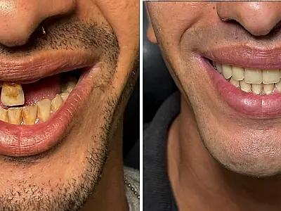 "Um Sorriso Muda o Mundo": Projeto transforma vidas ao devolver autoestima e saúde bucal