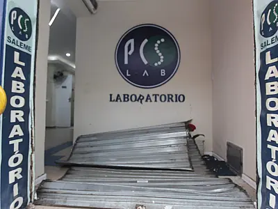 Transplante de córneas de doadores HIV positivos: pacientes permanecem saudáveis