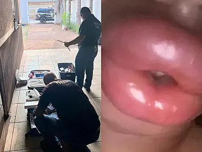 Investigação revela uso de silicone em óleo por falsa biomédica em Campo Grande