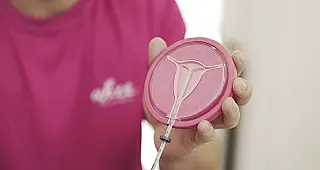 Planos de saúde terão que cobrir DIU hormonal para pacientes com endometriose