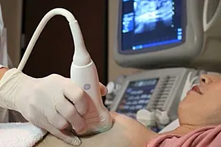 Mulheres a partir dos 40 anos podem fazer mamografia pelo SUS